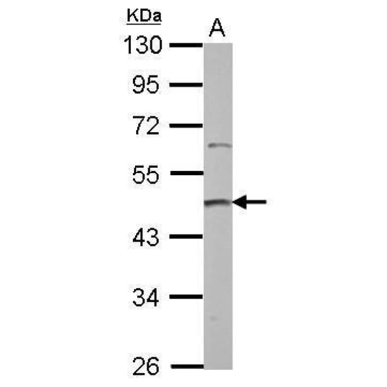 PRMT2 Antibody from Signalway Antibody (35409) - Antibodies.com