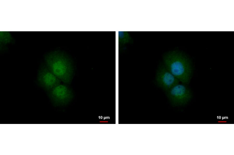 PRMT2 Antibody from Signalway Antibody (35409) - Antibodies.com