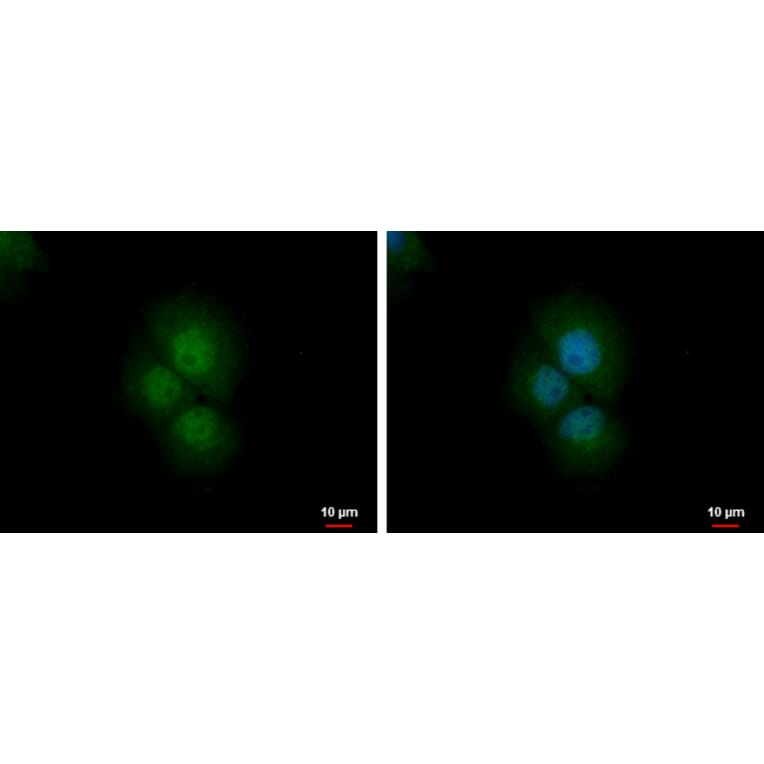 PRMT2 Antibody from Signalway Antibody (35409) - Antibodies.com