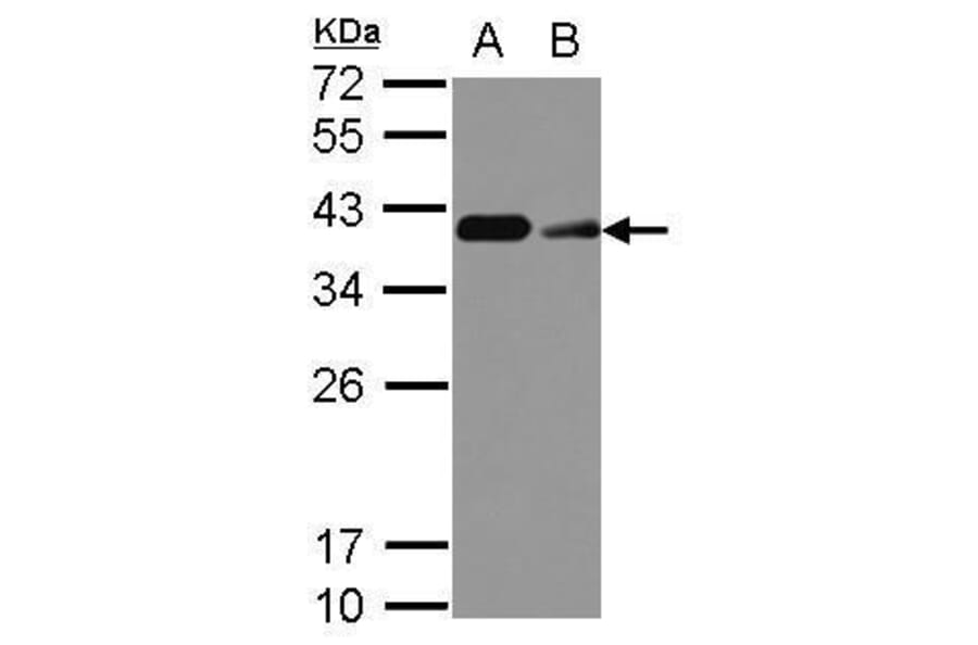 CD20 Antibody from Signalway Antibody (35339) - Antibodies.com