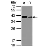 CD20 Antibody from Signalway Antibody (35339) - Antibodies.com