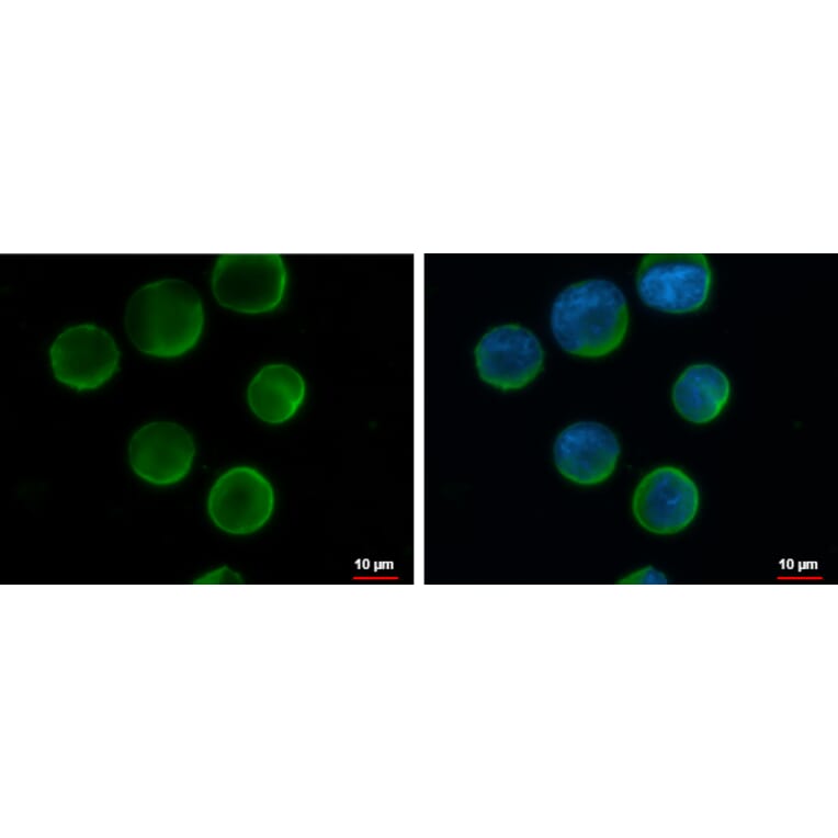 CD20 Antibody from Signalway Antibody (35339) - Antibodies.com