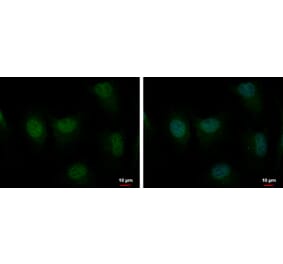 MSH2 Antibody from Signalway Antibody (35358) - Antibodies.com