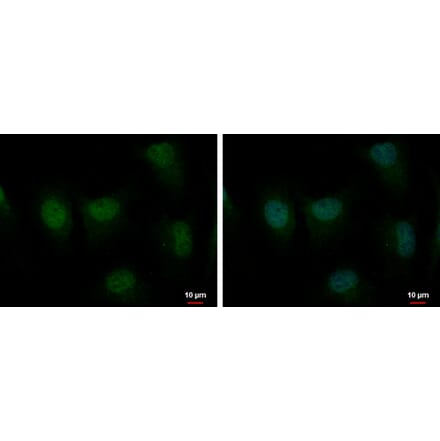 MSH2 Antibody from Signalway Antibody (35358) - Antibodies.com