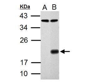 p21 Antibody from Signalway Antibody (35343) - Antibodies.com