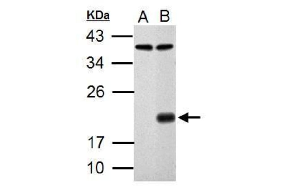 p21 Antibody from Signalway Antibody (35343) - Antibodies.com