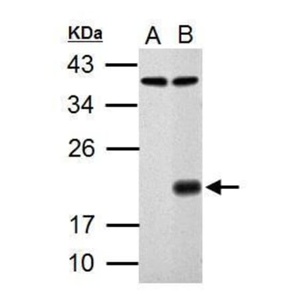 p21 Antibody from Signalway Antibody (35343) - Antibodies.com