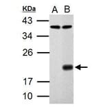 p21 Antibody from Signalway Antibody (35343) - Antibodies.com