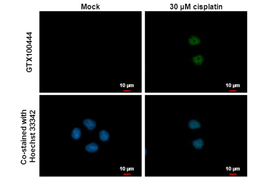 p21 Antibody from Signalway Antibody (35343) - Antibodies.com