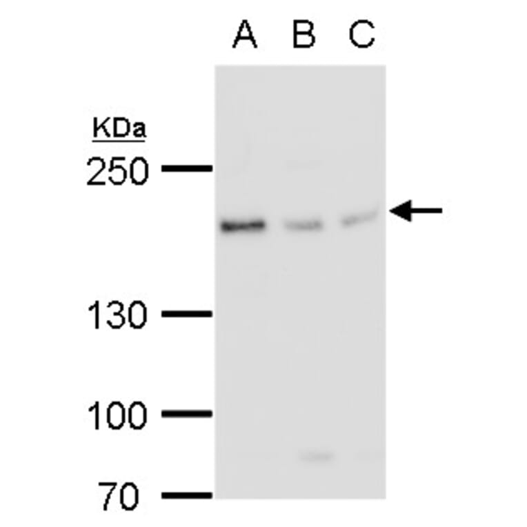BLM Antibody from Signalway Antibody (35370) - Antibodies.com