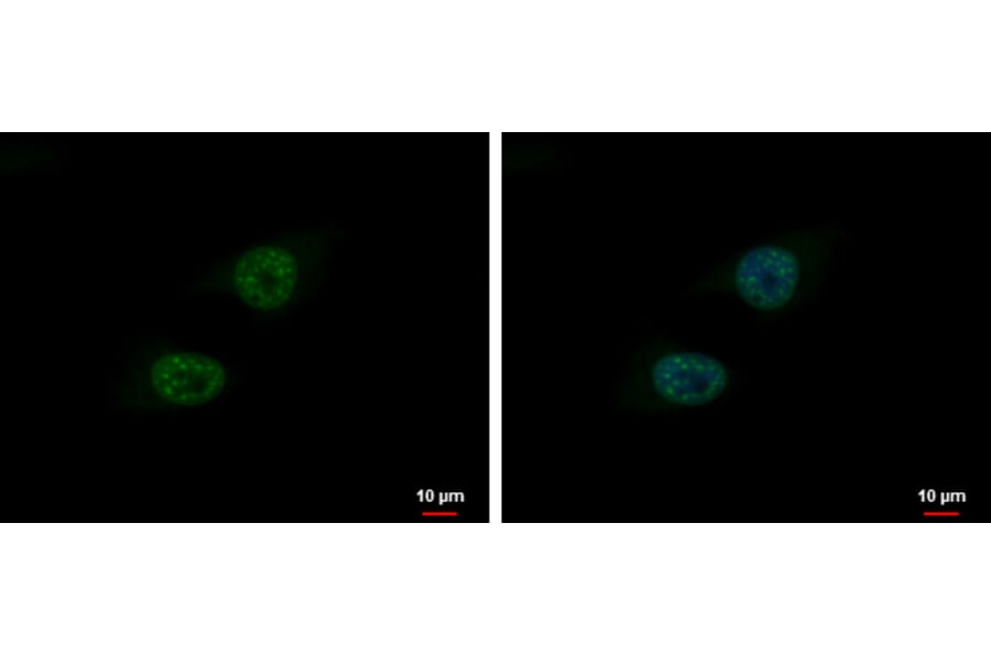 BLM Antibody from Signalway Antibody (35370) - Antibodies.com