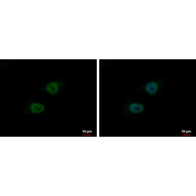 BLM Antibody from Signalway Antibody (35370) - Antibodies.com