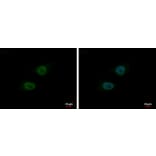 BLM Antibody from Signalway Antibody (35370) - Antibodies.com