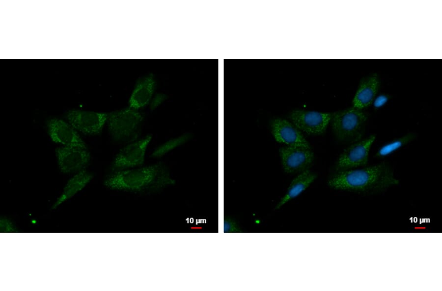 FGR Antibody from Signalway Antibody (35401) - Antibodies.com