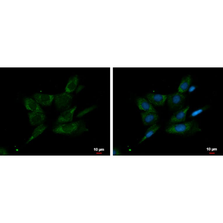 FGR Antibody from Signalway Antibody (35401) - Antibodies.com