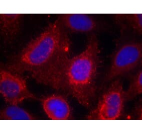 Immunofluorescence - TrkA (Ab-791) Antibody from Signalway Antibody (21326) - Antibodies.com