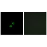 Immunofluorescence analysis of A549 cells, using KIR2DL5B antibody #34752.