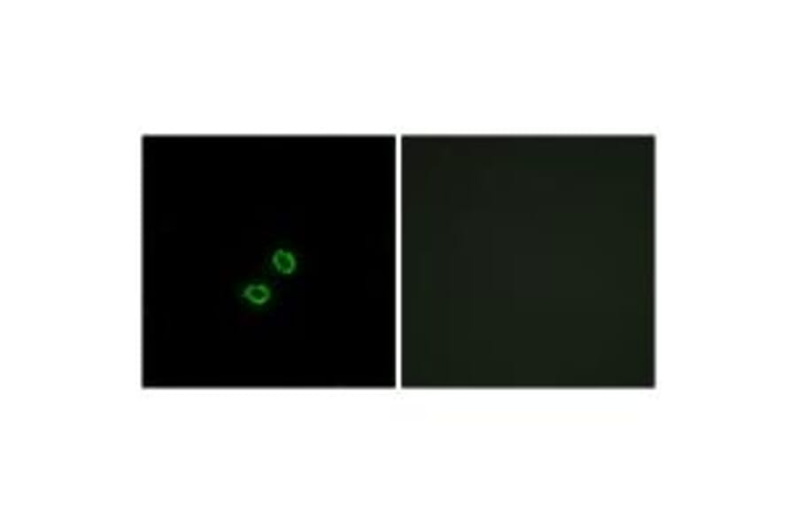Immunofluorescence - KIR2DL5B Antibody from Signalway Antibody (34752) - Antibodies.com