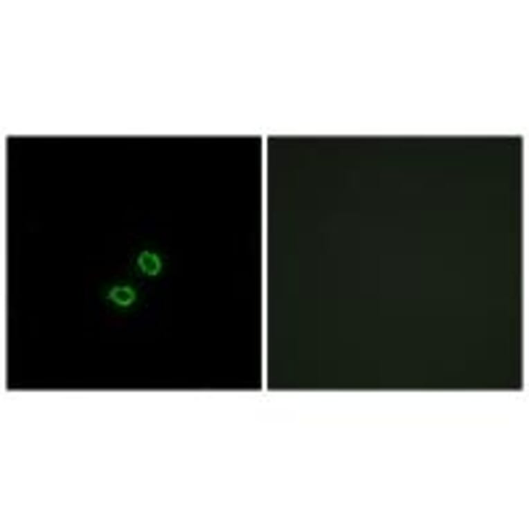 Immunofluorescence - KIR2DL5B Antibody from Signalway Antibody (34752) - Antibodies.com
