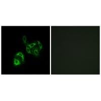 Immunofluorescence analysis of A549 cells, using SLC27A4 antibody #34761.