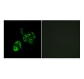 Immunofluorescence - SLC27A4 Antibody from Signalway Antibody (34761) - Antibodies.com