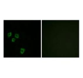 Immunofluorescence - MUC16 Antibody from Signalway Antibody (33999) - Antibodies.com