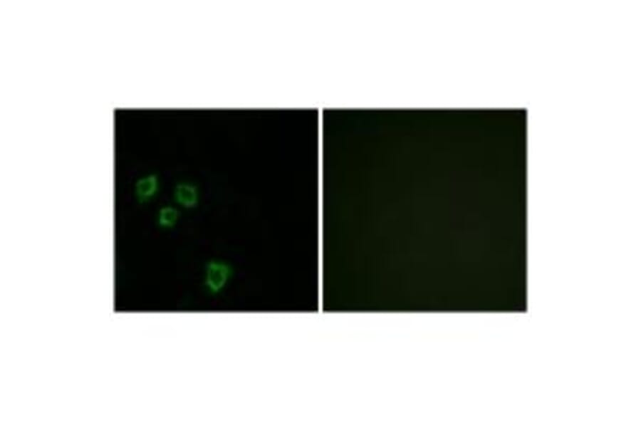 Immunofluorescence - MUC16 Antibody from Signalway Antibody (33999) - Antibodies.com