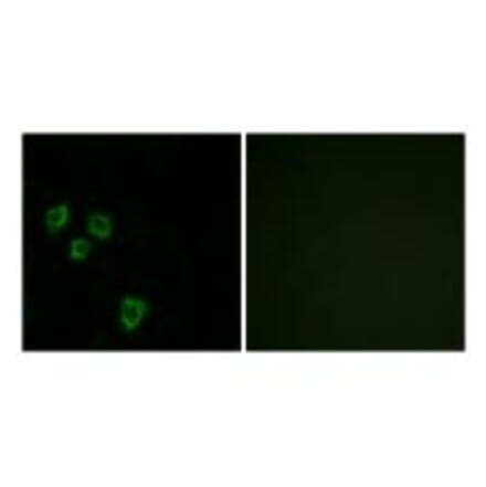 Immunofluorescence - MUC16 Antibody from Signalway Antibody (33999) - Antibodies.com