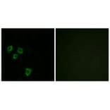 Immunofluorescence - MUC16 Antibody from Signalway Antibody (33999) - Antibodies.com