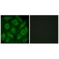 Immunofluorescence analysis of HeLa cells, using CDH23 antibody #34179.