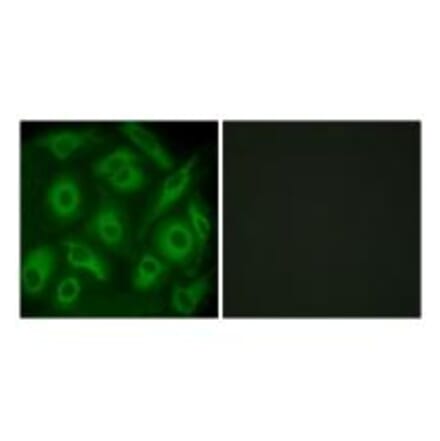 Immunofluorescence - CDH23 Antibody from Signalway Antibody (34179) - Antibodies.com