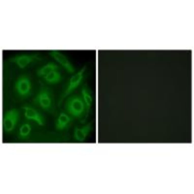 Immunofluorescence - CDH23 Antibody from Signalway Antibody (34179) - Antibodies.com
