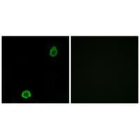Immunofluorescence analysis of A549 cells, using ABCA13 antibody #34456.