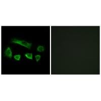 Immunofluorescence analysis of A549 cells, using NT5C1B antibody #34635.