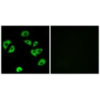 Immunofluorescence analysis of A549 cells, using LILRB4 antibody #34759.