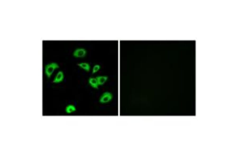 Immunofluorescence - LILRB4 Antibody from Signalway Antibody (34759) - Antibodies.com