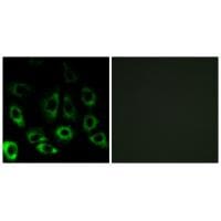 Immunofluorescence analysis of A549 cells, using MBTPS2 antibody #34784.
