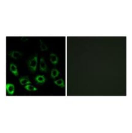 Immunofluorescence - MBTPS2 Antibody from Signalway Antibody (34784) - Antibodies.com