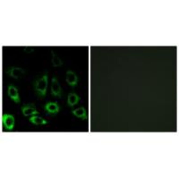 Immunofluorescence - MBTPS2 Antibody from Signalway Antibody (34784) - Antibodies.com