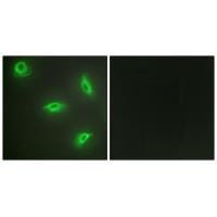 Immunofluorescence analysis of HeLa cells, using TNF14 antibody #33586.