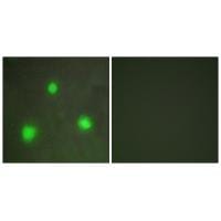 Immunofluorescence analysis of A549 cells, using FOXH1 antibody #33616.