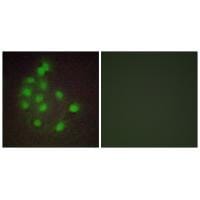 Immunofluorescence analysis of A549 cells, using HAND1 antibody #33643.