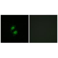 Immunofluorescence analysis of A549 cells, using ZNF95 antibody #34129.