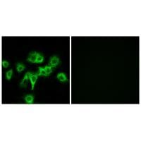 Immunofluorescence analysis of MCF-7 cells, using CDON antibody #34196.