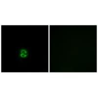 Immunofluorescence analysis of A549 cells, using CHST6 antibody #34535.