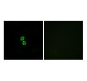 Immunofluorescence - CKLF1 Antibody from Signalway Antibody (34592) - Antibodies.com