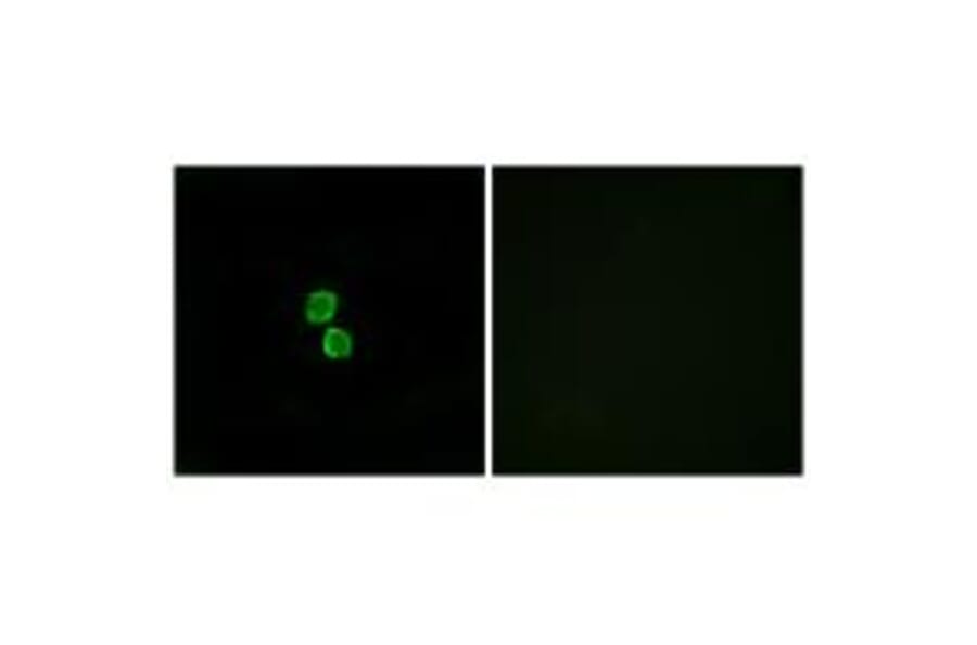 Immunofluorescence - CKLF1 Antibody from Signalway Antibody (34592) - Antibodies.com