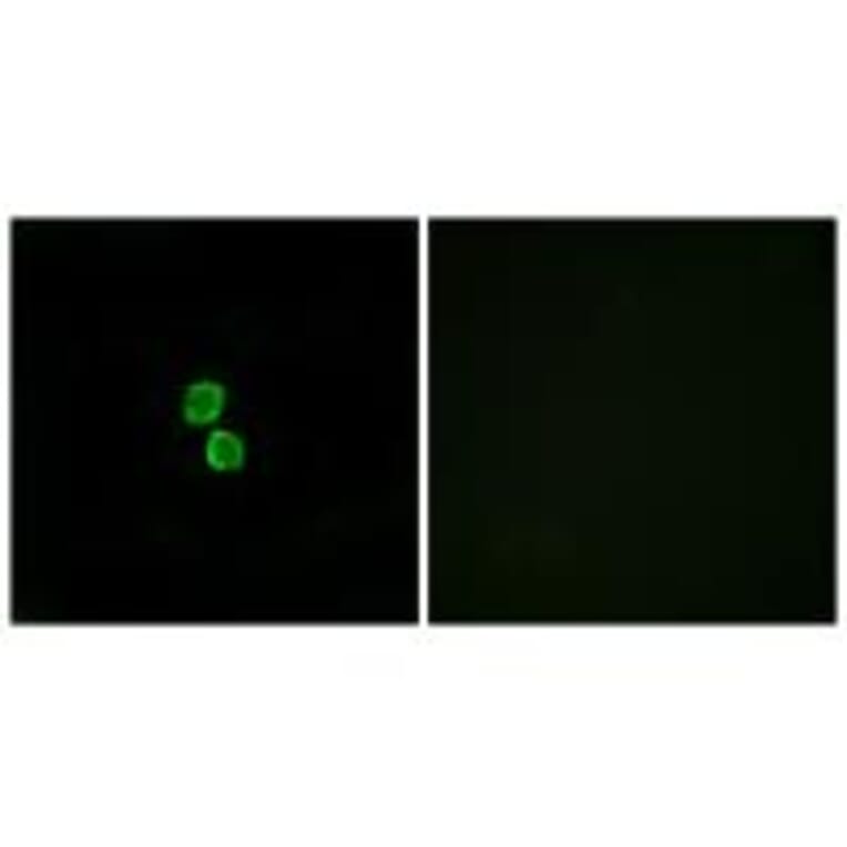 Immunofluorescence - CKLF1 Antibody from Signalway Antibody (34592) - Antibodies.com