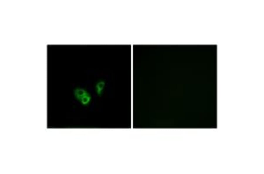 Immunofluorescence - CNGA2 Antibody from Signalway Antibody (34625) - Antibodies.com