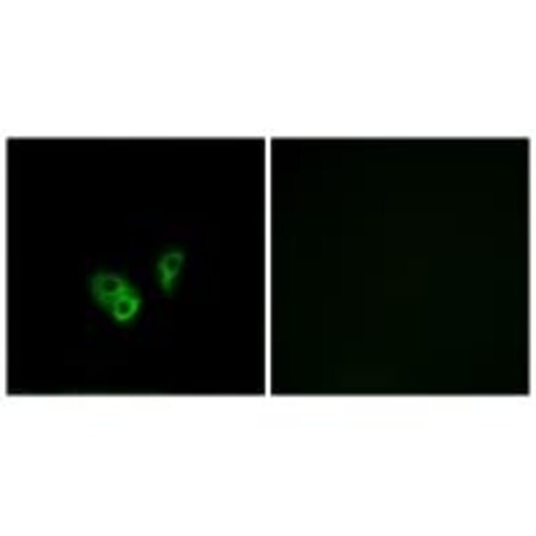 Immunofluorescence - CNGA2 Antibody from Signalway Antibody (34625) - Antibodies.com